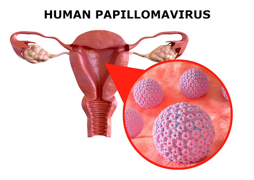 A maioria das variações do HPV não causa sintomas, mas algumas causam infecções e até câncer. (Fonte: Shutterstock/Reprodução)