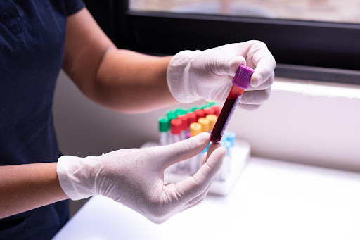 Teste de Gravidez: é melhor o exame de sangue ou de farmácia?