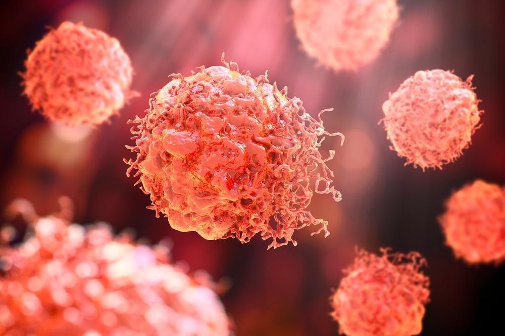 Imunoterapia pode ajudar na redução do desenvolvimento da doença. (Fonte: Shutterstock/Reprodução)