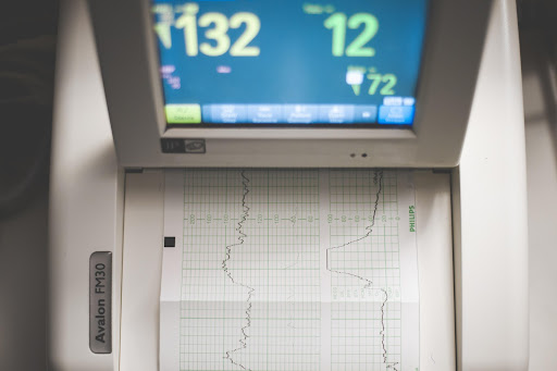 A partir dos gráficos emitidos pelo aparelho, o especialista poderá analisar se há ou não alguma alteração no ritmo cardíaco. (Fonte: Pexels/Reprodução)