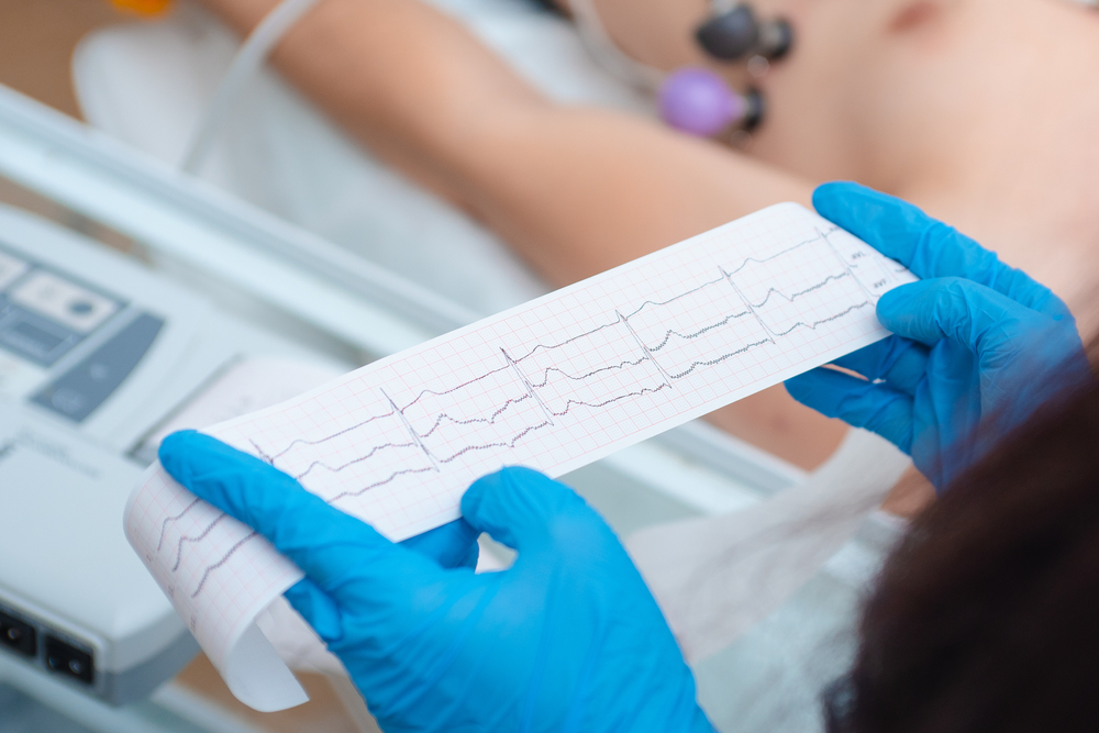 Para mensurar o risco cardíaco pré-cirúrgico, são solicitados exames como o eletrocardiograma. (Fonte: Shutterstock/Reprodução)