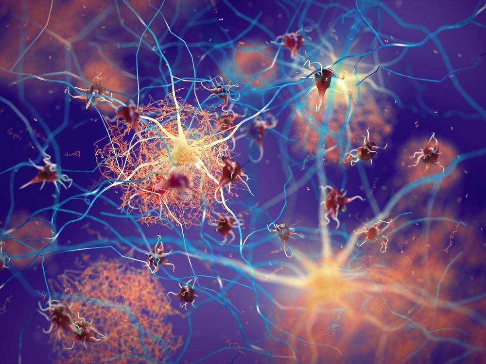 As células cerebrais são as principais afetadas pelos efeitos da droga. (Fonte: Shutterstock)