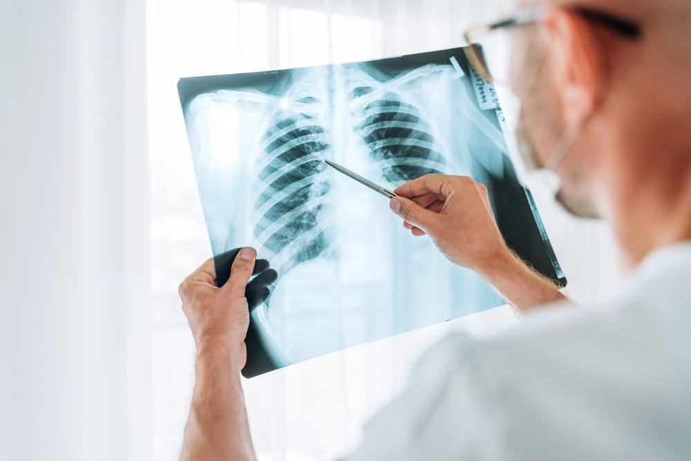 Os danos aos órgãos foram detectados por meio de exames de imagens feitos nos pacientes. (Fonte: Shutterstock)
