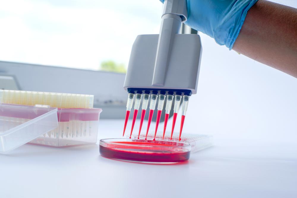 O exame rastreia fragmentos de DNA da bactéria causadora da tuberculose no sangue. (Fonte: Shutterstock)