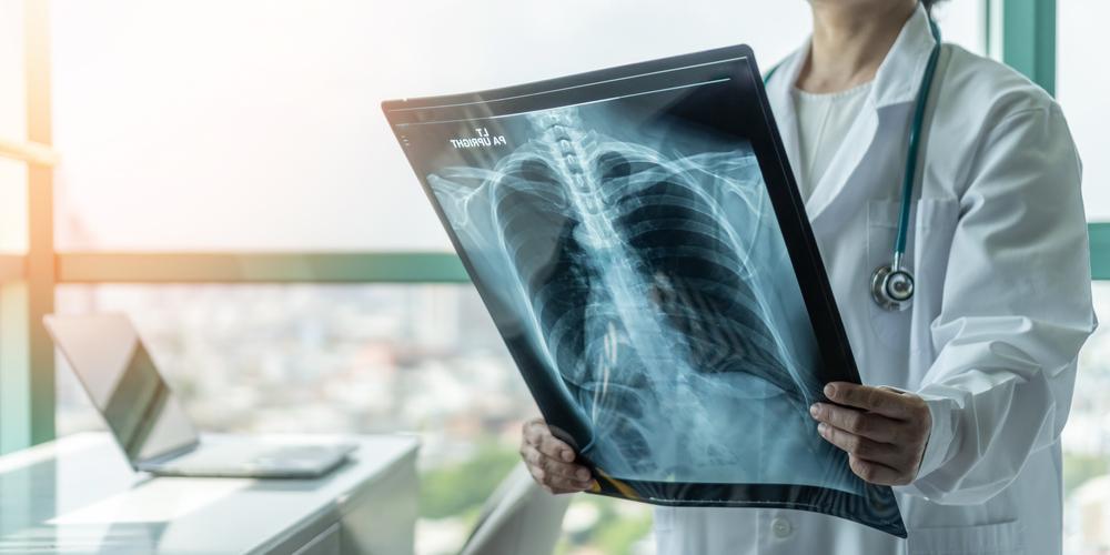 Há muitas dúvidas sobre o que é pneumonia e as suas semelhanças com outras doenças respiratórias. (Fonte: Shutterstock)