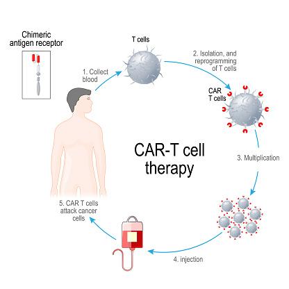 Tratamento CAR T permite que células de defesa do corpo geneticamente modificadas combatam tumores