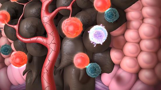 Tratamento reprograma células do sistema imunológico para combater com mais eficiência o mieloma. (Fonte: Getty Images/Reprodução)